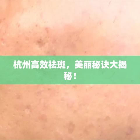 杭州高效祛斑，美麗秘訣大揭秘！