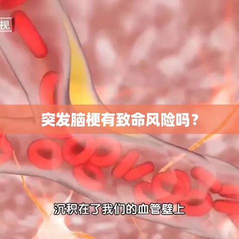 突發(fā)腦梗有致命風(fēng)險(xiǎn)嗎？