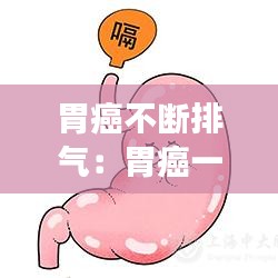 胃癌不斷排氣：胃癌一直放屁嗎 