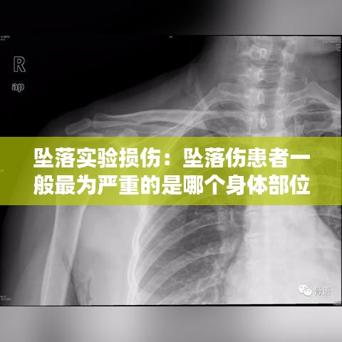 墜落實(shí)驗(yàn)損傷：墜落傷患者一般最為嚴(yán)重的是哪個(gè)身體部位 