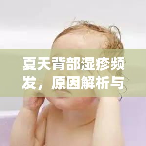 夏天背部濕疹頻發(fā)，原因解析與應(yīng)對方法