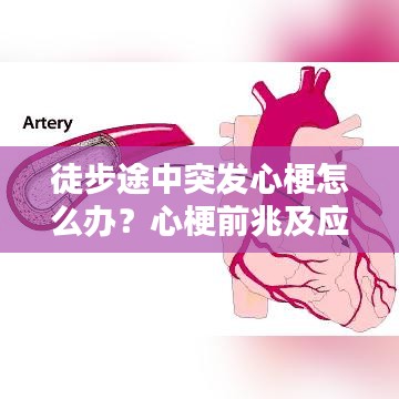 徒步途中突發(fā)心梗怎么辦？心梗前兆及應(yīng)對(duì)措施科普！