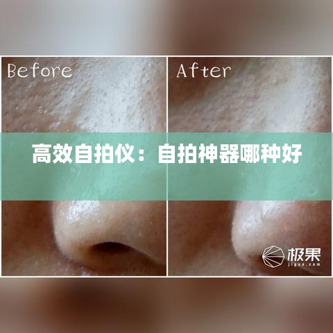 高效自拍儀：自拍神器哪種好 