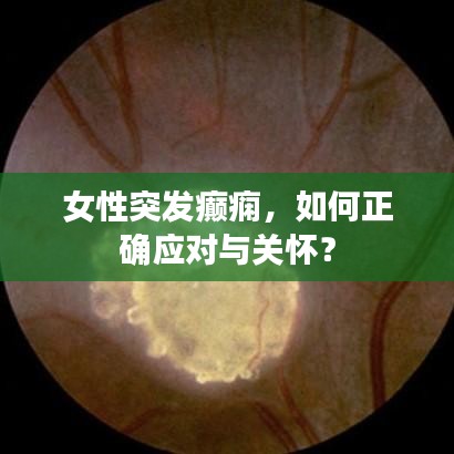 女性突發(fā)癲癇，如何正確應(yīng)對(duì)與關(guān)懷？