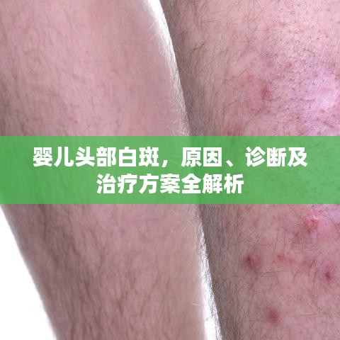 嬰兒頭部白斑，原因、診斷及治療方案全解析